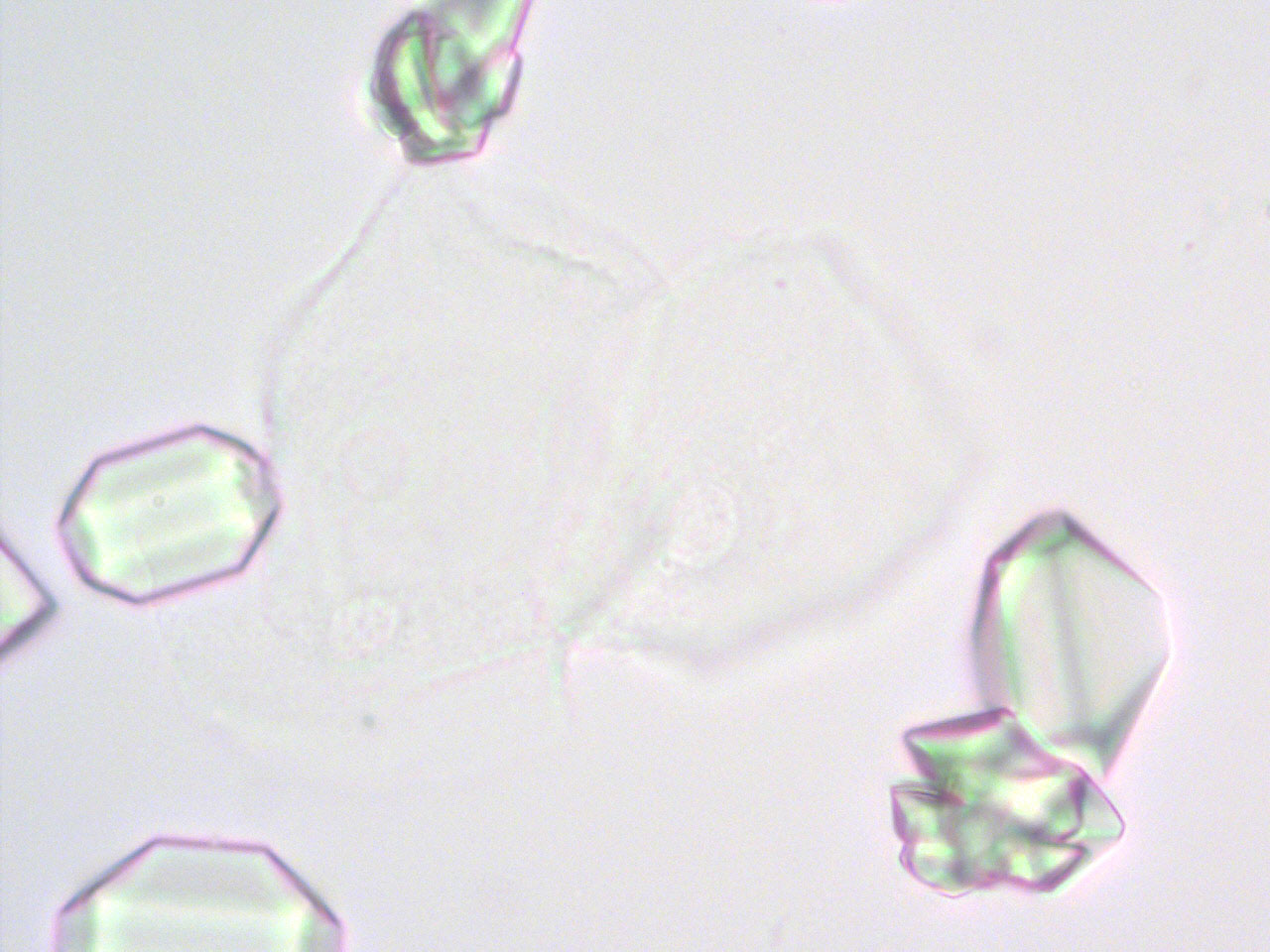 Плоский эпителий в моче у собаки, кота | Атлас ветеринарной академии ...